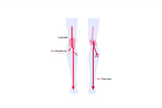 Comment améliorer la circulation des jambes lourdes naturellement